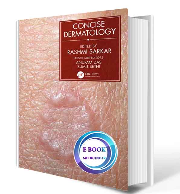 دانلود کتابConcise Dermatology 2021 (Original PDF)